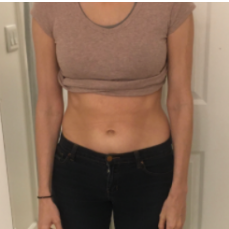 A picture of Kendra Hemminger’s abs after 3 weeks of Reclaim.